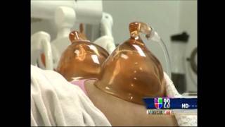 Levantamiento de Gluteos sin cirugia con el AZ-Shape Plus