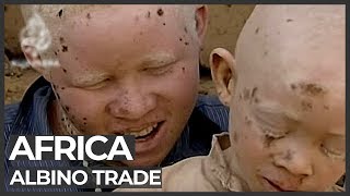 Albino body organs sold for witchcraft