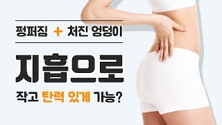 처진 엉덩이, 지방흡입으로 작고 탄력 있게 가능?(feat.지흡전후)