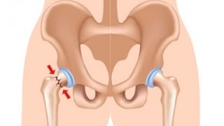 ▼Опорно  Двигательный Аппарат и Его Повреждения▼|▼Musculoskeletal System. Damage▼