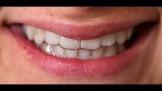 Clear Aligner - Erfahrungen mit unsichtbaren Zahnspangen. www.zahnspangen.de