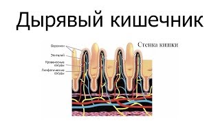 Дырявый кишечник (Джон МакДугалл)