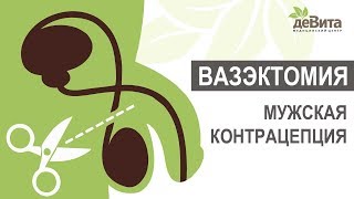 Вазэктомия — мужская хирургическая контрацепция