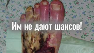 Против ампутации