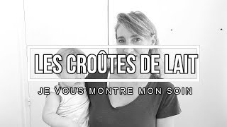 LE SOIN EN PRATIQUE POUR SE DÉBARRASSER DES CROUTES DE LAIT