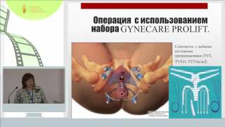 Антошечкина М.А. - Возможности хирургической коррекции пролапса гениталий