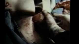 Лики смерти: Операция по перемене пола.