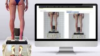 SprintWARE medical - sistema di valutazione della postura per immagini