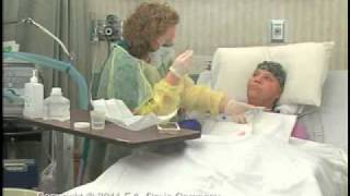 Suctioning Tracheostomy, Open System