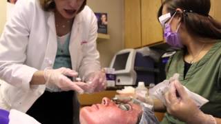 Microlaser Peel