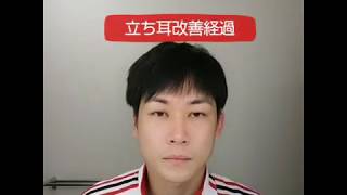 立ち耳(猿耳)改善経過