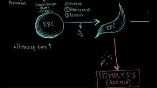 sickle cell anemia 3