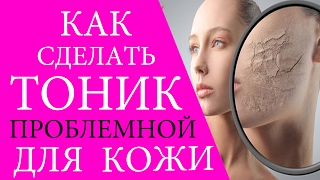 Тоник для проблемной кожи. Делаем Тоник в Домашних Условиях