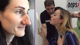 СНИМАЮТ ГИПС! САМЫЙ СЛОЖНЫЙ НОС! ОБЫЧАИ ИРАНА