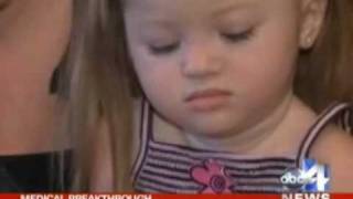 New Hope For Patients With Spinal Muscular Atrophy (SMA)