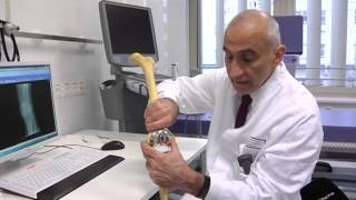 Endoprothetik - ein neues Kniegelenk für Manfred Paczkowski in der Unfallchirurgie