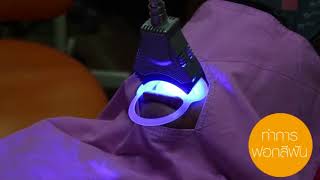 cool light  คลินิกทันตกรรมสยามสเตชั่น
