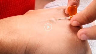 Fair with Gluta | Self IV Insertion on my arm