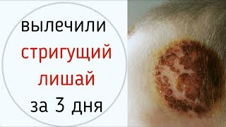 Вылечить лишай за 3 дня! Трихофития больше не страшна.