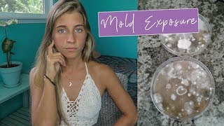 STRUGGLING WITH MOLD EXPOSURE