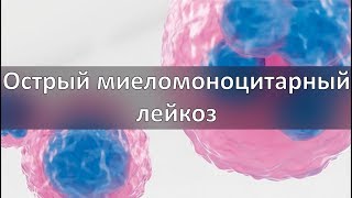 Острый миеломоноцитарный лейкоз
