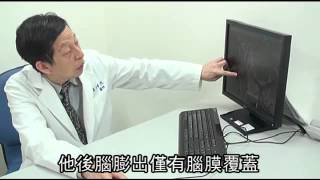太愛小孩 投入冷門科 雷大雅救水腦病童- 蘋果日報
