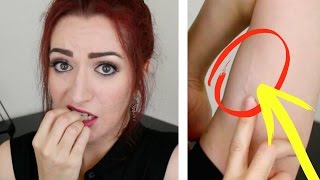 NO PERIOD FOR 5 YEARS?! My Implanon/Nexplanon Contraceptive Implant Experience