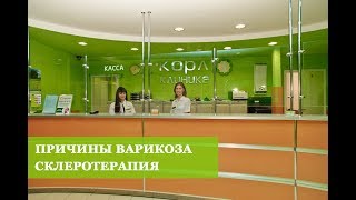 Лечение варикоза.