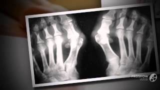 valgus pro отзывы

  - Вальгус про недорого купить.