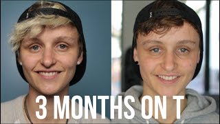 3 months on testosterone [non binary trans guy]