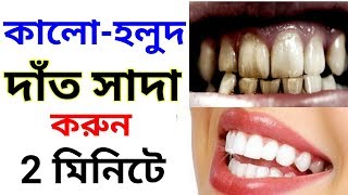 দাঁত সাদা করুন ২ মিনিটে । Teeth whitening at home Health Bangla Tips