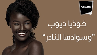 "خوذيا ديوب".. سيدة الميلانين وسوادها النادر