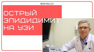 Эпидидимит, при УЗИ мошонки