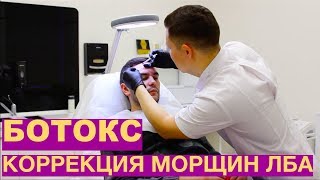 Ботулинотерапия морщин лба / Dr Rinat Sitanovich
