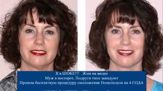 Мазь Солкосерил От Морщин [Мазь Солкосерил От Морщин]