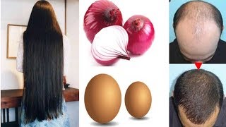 Hair Growth Tips In Malayalam|| Hair Growth Faster|| How To Use Onion For Fast Hair Growth