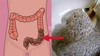 Eliminate All Stuck Stools And Get Rid Of Belly Bloat With A Single Spoonful Of This!