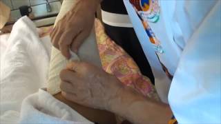 Edema treatment 4 measure and bandage