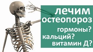 Остеопороз костей. ? Какое лечение выбрать при остеопорозе костей. ЦЭЛТ