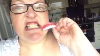 eBay perfect smile veneers FAIL