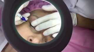 גלינה ביוטי - איפור קבוע אייליינר Galina Beauty - Permanent eyeliner
