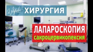 Лапароскопия  Сакроцервикопексия