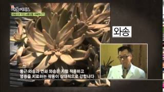 와송으로 뇌종양을 이겨내다!_채널A_신대동여지도 36회