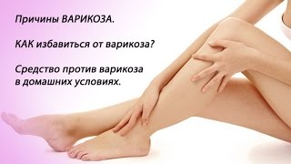 Как избавиться от варикоза?