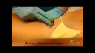 Шугаринг бикини в нашей студии