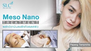 คุณพะแพง พบทางแก้ปัญหาหน้าดำคล้ำ ไม่เรียบเนียน ผิวหน้าไม่สดใส : Meso Nano Treatment ที่ SLC