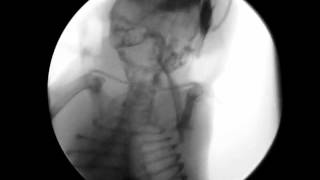 Mouse Swallowing X-ray