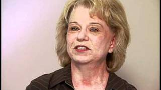 Fraxel Laser Treatment Patient Testimonials | Skin Solutions Laser Center