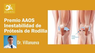 Premio Dr. Manuel Villanueva Inestabilidad Prótesis de Rodilla AAOS