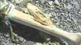 Mount Everest Mallory & Irvine 1924 Discovery Of Mallory's body